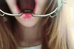 open-mouth